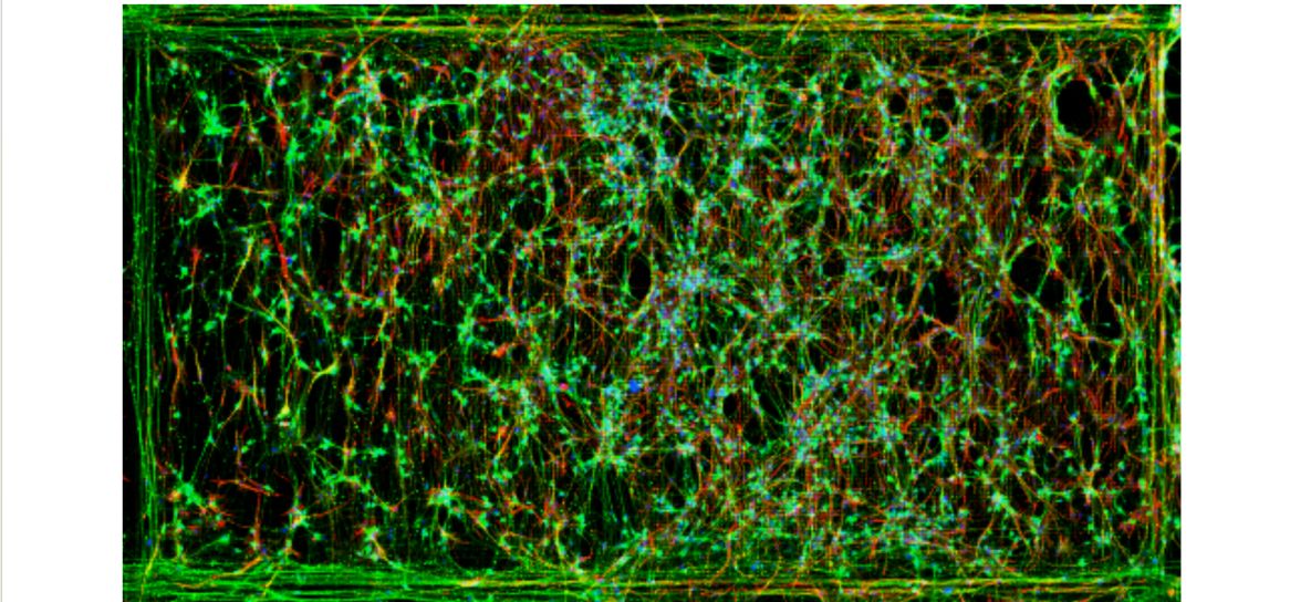 Neuronal cultures plated onto MaxOne HD-MEA sensor area